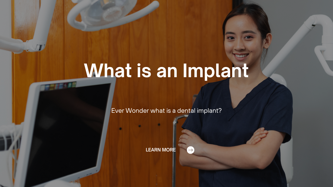 What is an Implant